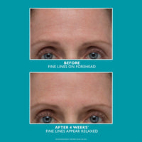 Peptide Skinjection Wrinkle Fix Serum 30ml