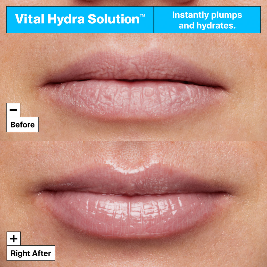 Vital Hydra Solution Hydrating Lip Mask