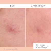 S.O.S Clarifying liquid Patch