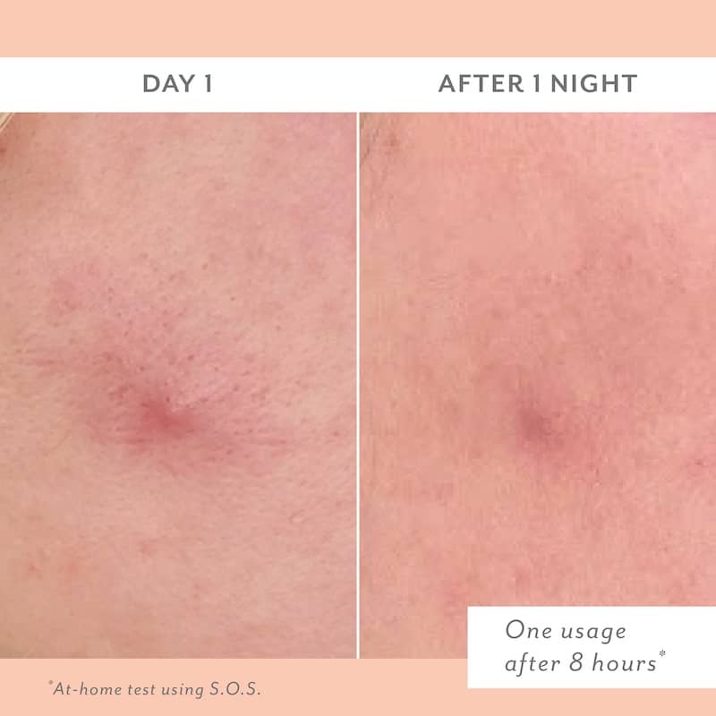 S.O.S Clarifying liquid Patch